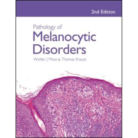 Pathology of Melanocytic Disorders 2ed