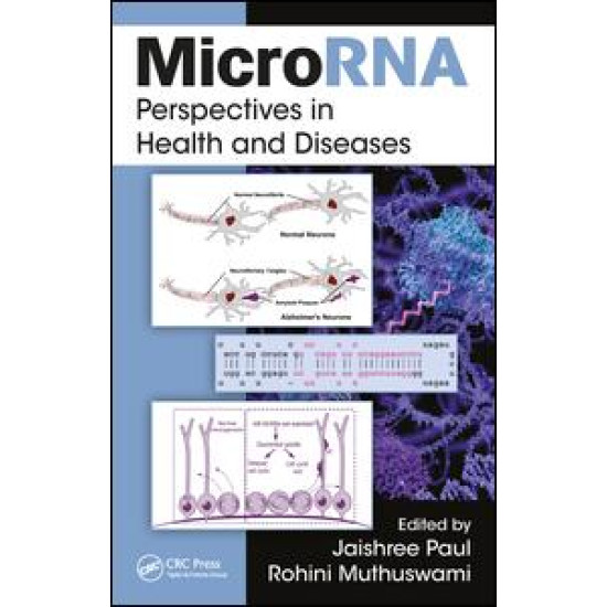 MicroRNA