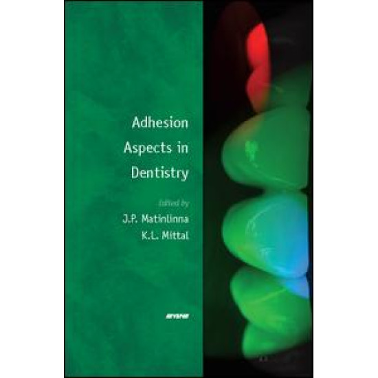 Adhesion Aspects in Dentistry