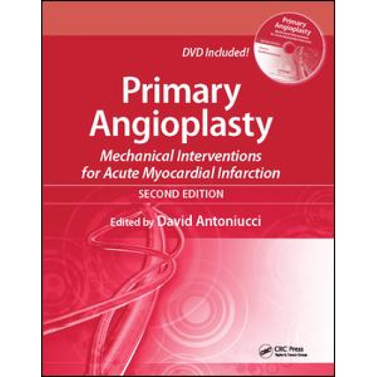 Primary Angioplasty