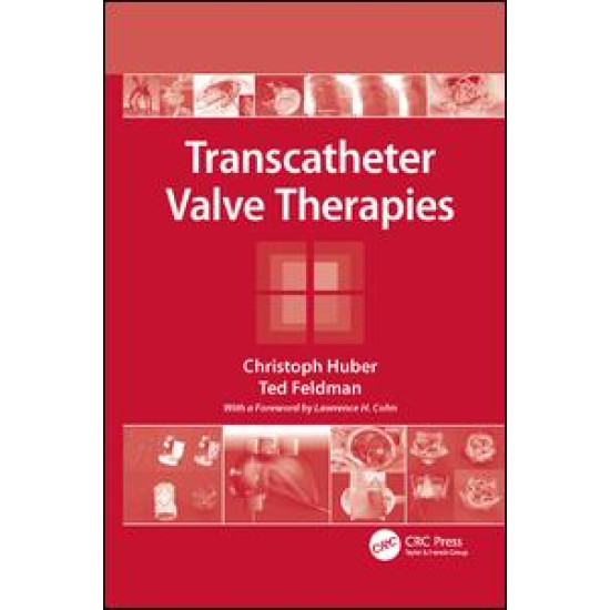 Transcatheter Valve Therapies