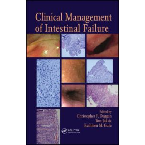Clinical Management of Intestinal Failure