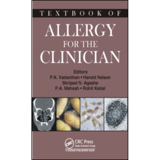 Textbook of Allergy for the Clinician